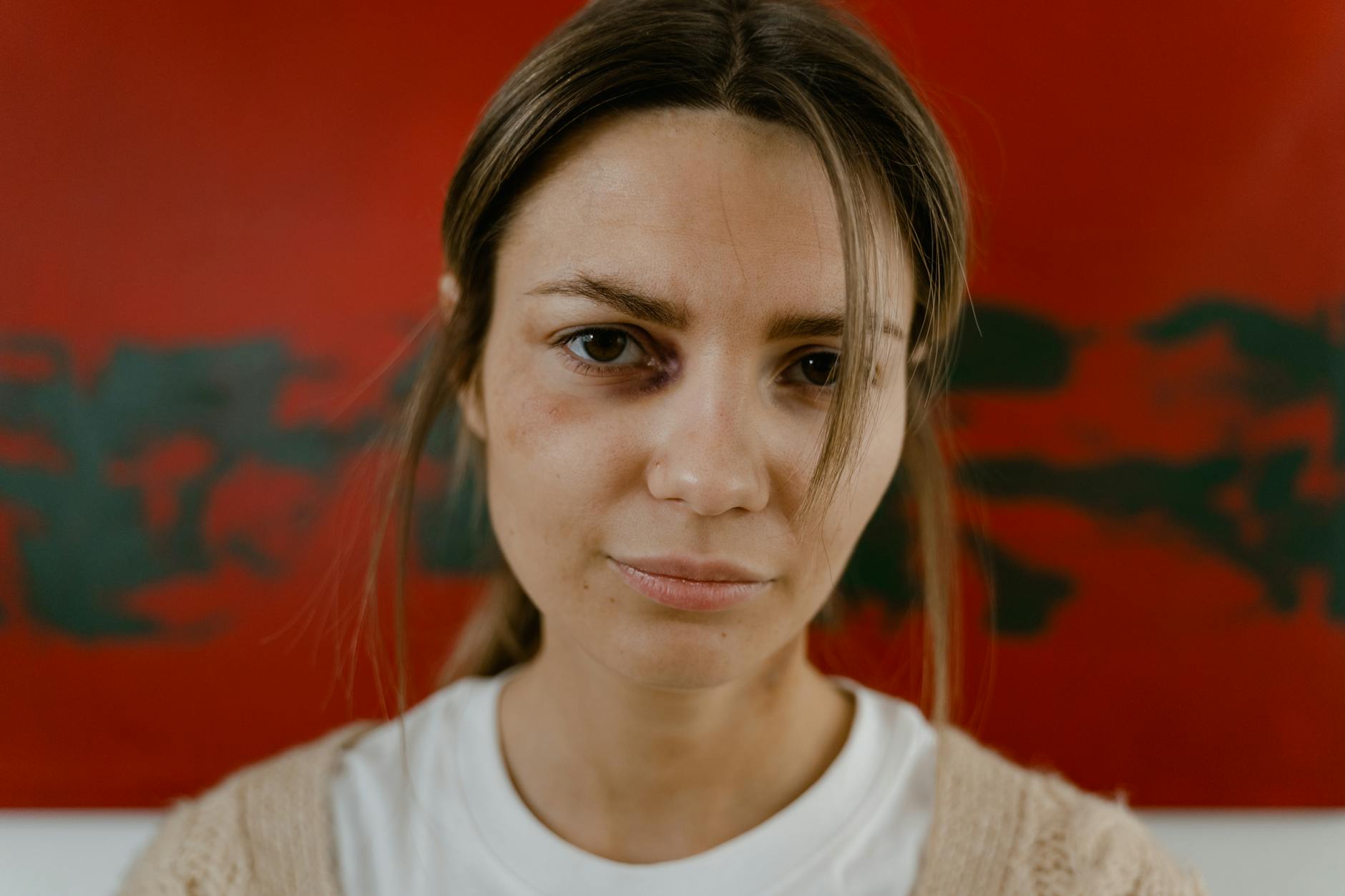 Why Does Your Back Hurt When You Run — and Who Is Most at Risk?