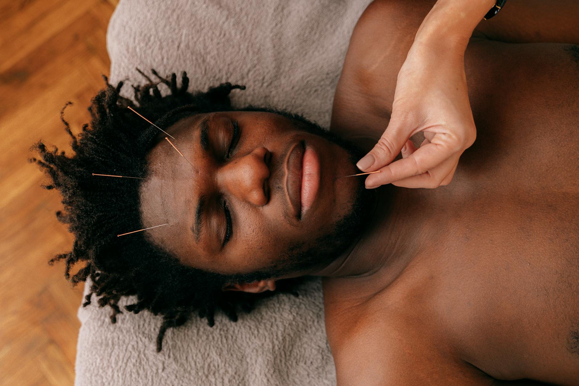 Acupuncture and Dry Needling for Neuroendocrine Recovery