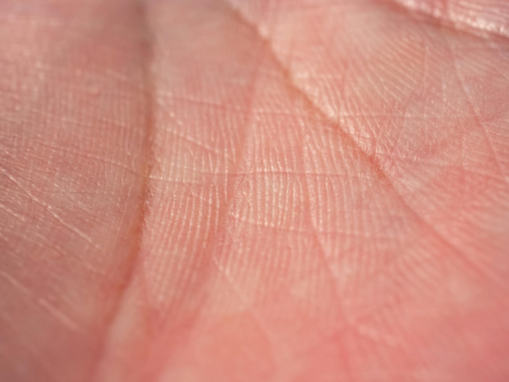 What Happens to Your Skin When You Run with Chafing?