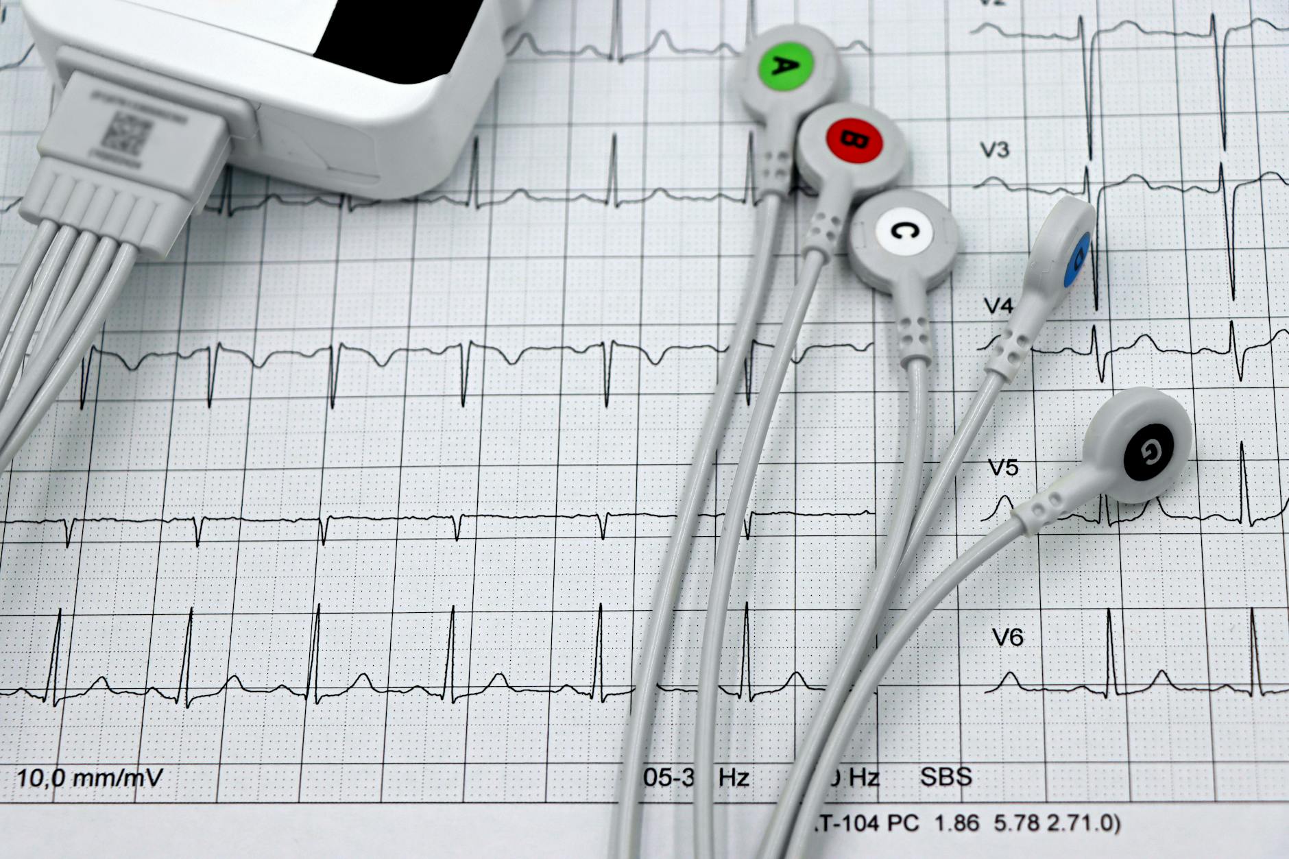 What Heart Rate Zone Optimizes Fat Oxidation During Running?