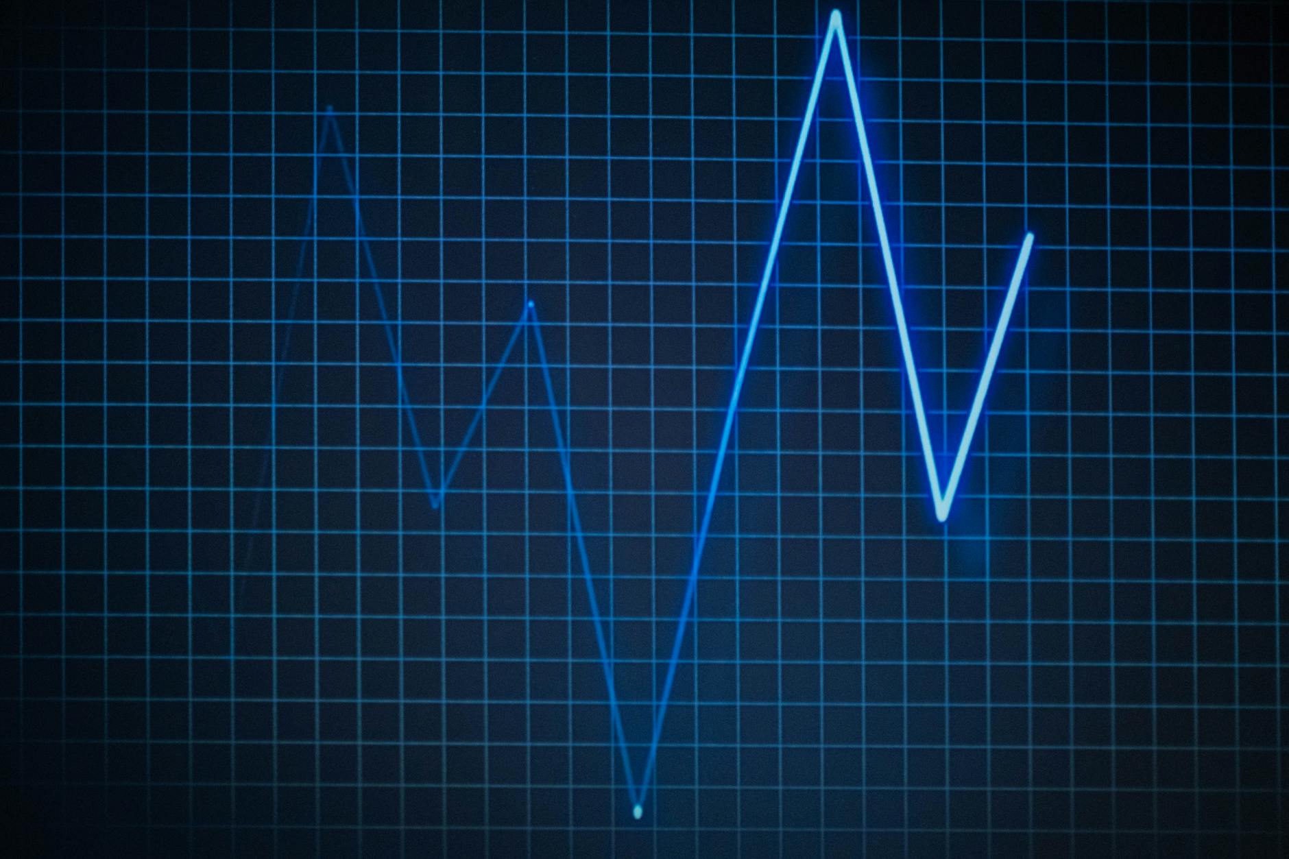 Why Does Your Heart Rate Stay Elevated After Exercise?