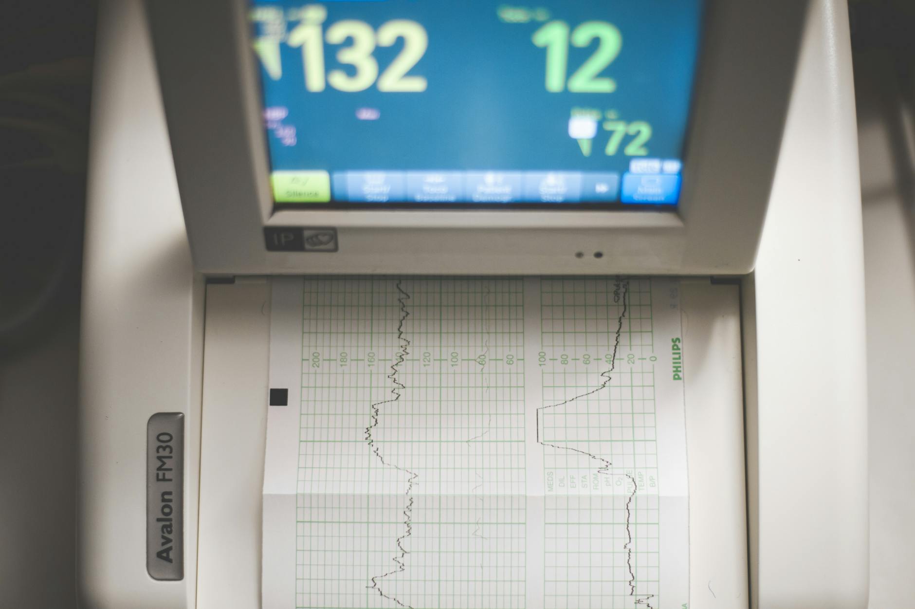Why Heart Rate Zones Matter More for Runners Over 40