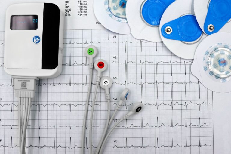 How My Resting Heart Rate Affects My Running Intensity Minutes - Featured image