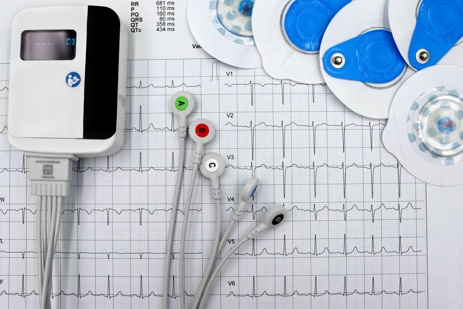 Understanding Your Genetic Heart Rate Ceiling