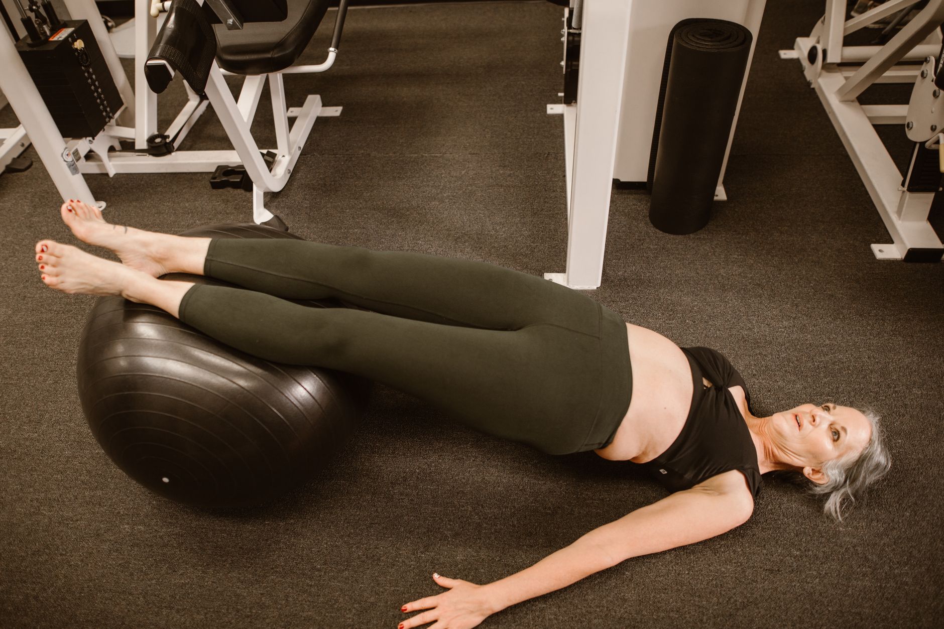 Hormonal Changes, Medications, and Bone Loss Despite Exercise