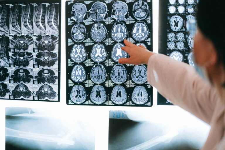 How Cardio Changes Your Brain - Featured image