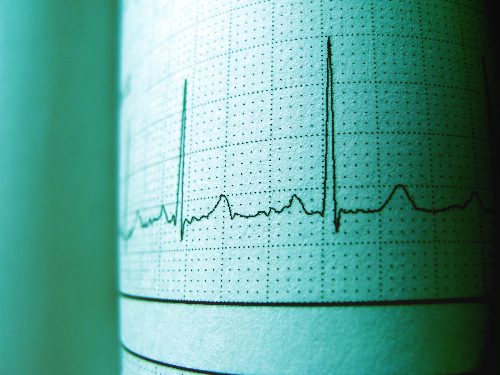 How Heart Rate Zones Structure Functional Fitness Training